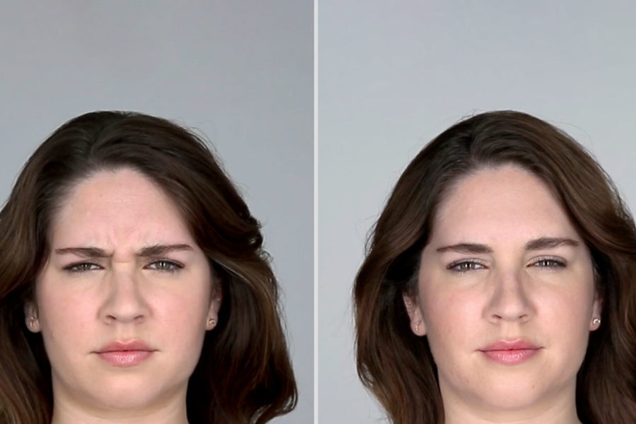 Botox in Golden, CO | Golden Laser Aesthetics