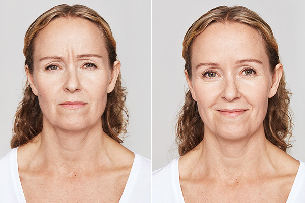 gl-dyport-subpage-4a gl-dyport-subpage-4a