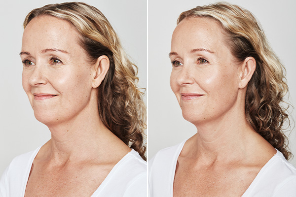 gl-dyport-subpage-4b gl-dyport-subpage-4b